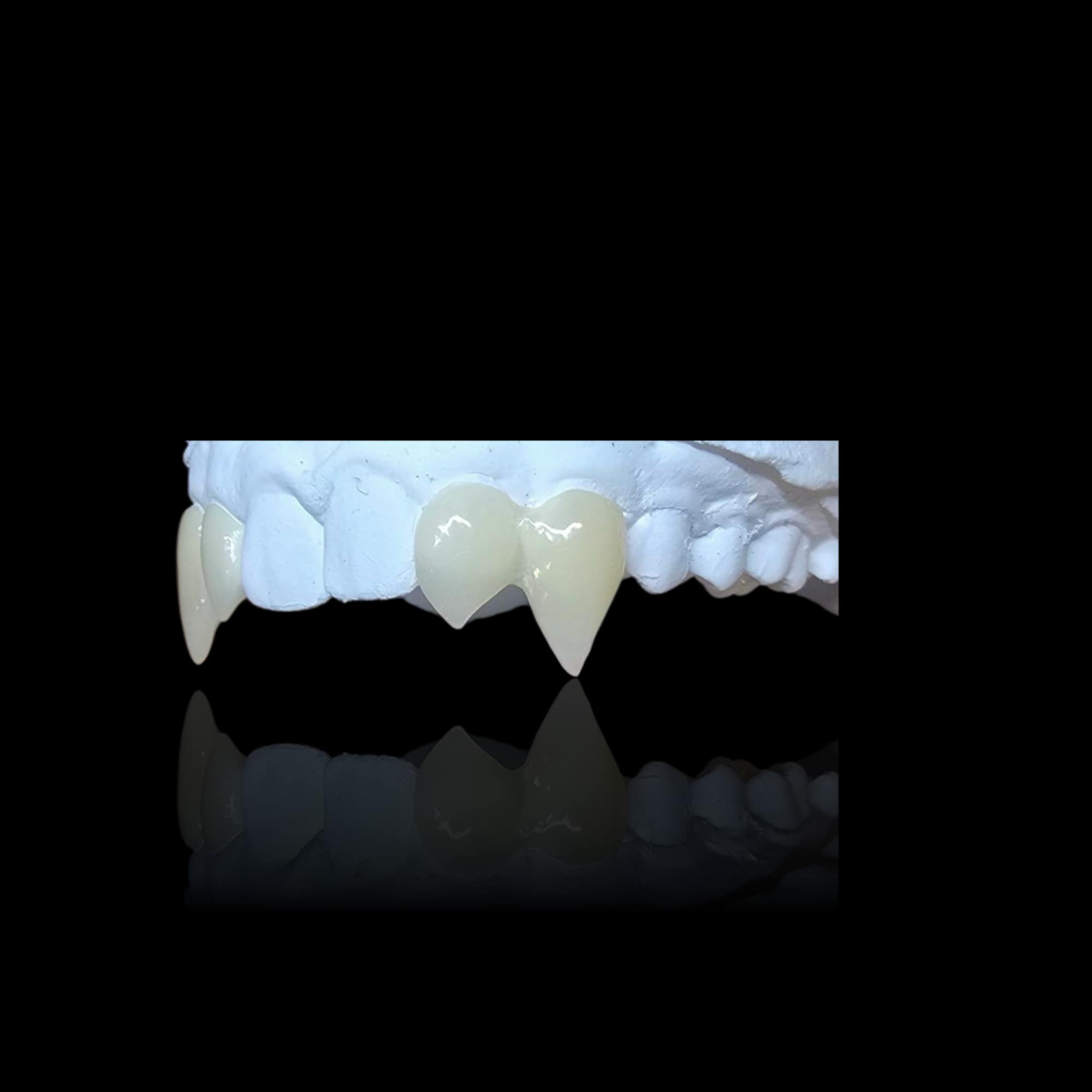 Custom Vampire & Fantasy Fangs