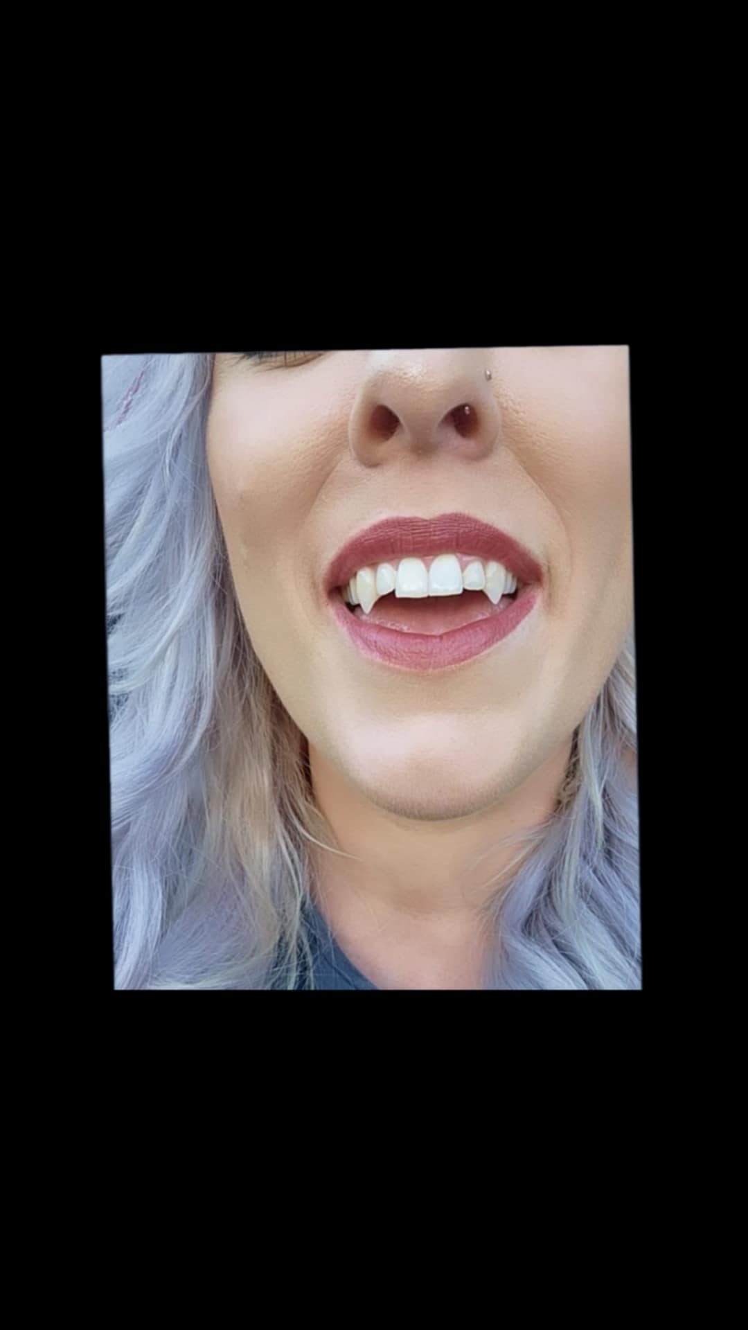 Custom Vampire & Fantasy Fangs